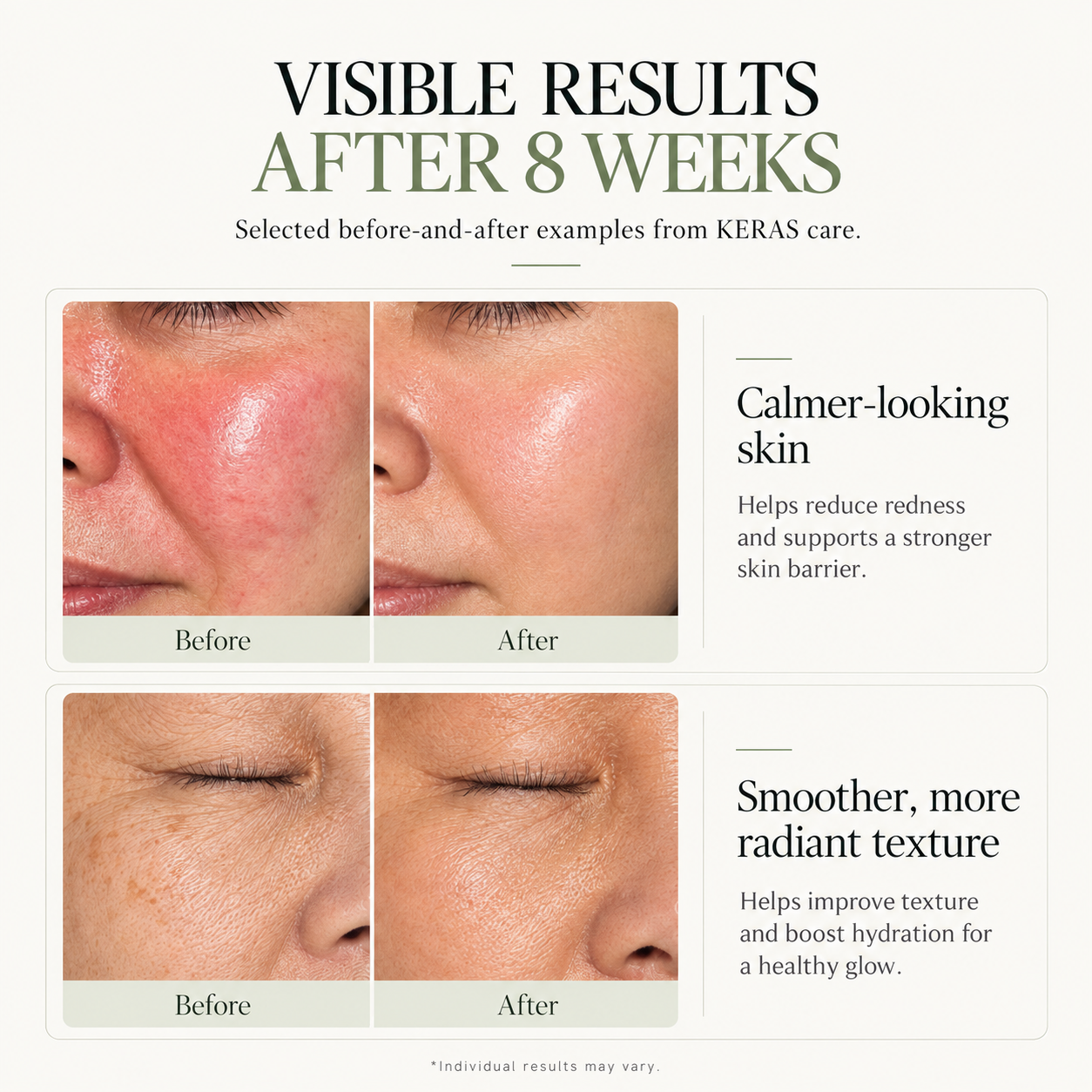 MADLY Dermal Regeneration Cream
